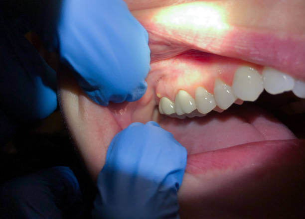 Best Emergency Dentist for Special Needs Patients in Rolla, ND