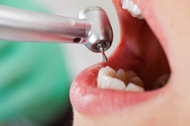 Best Emergency Cosmetic Dentistry in Rolla, ND